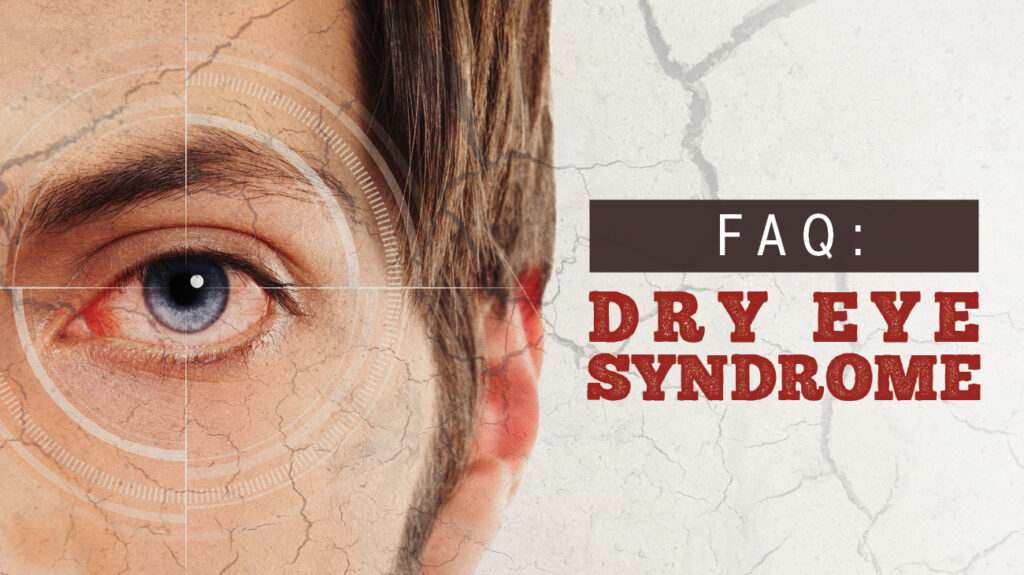 FAQ Dry Eye Syndrome