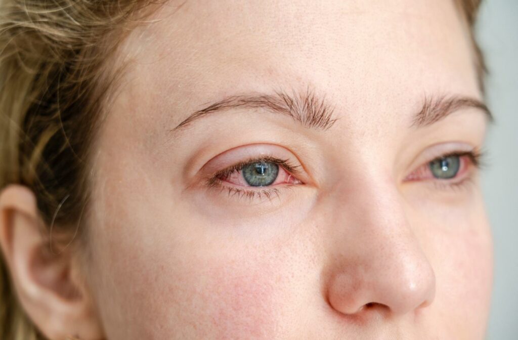 A close up of a person with red eyes